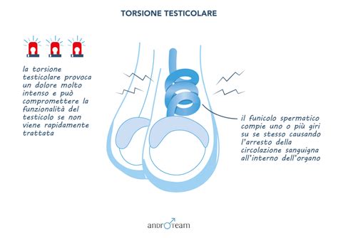 Schema della torsione testicolare