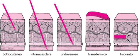 Schema comparativo tra diversi metodi di somministrazione vaginale