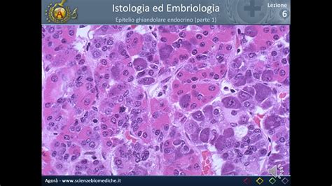 Esito istologico al microscopio
