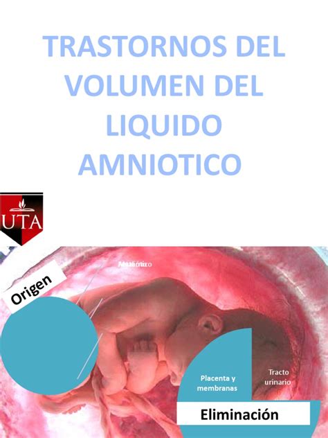 Grafico semplificato dell'evoluzione del volume del liquido amniotico durante la gravidanza