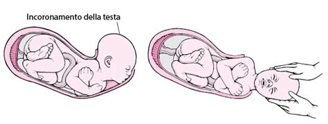 Illustrazione delle fasi del travaglio