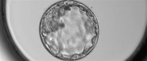 Microscopio da laboratorio con embrioni in fase di sviluppo