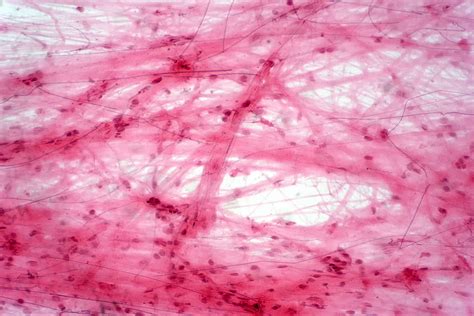 Struttura a trama aperta di un tessuto a rete visto al microscopio