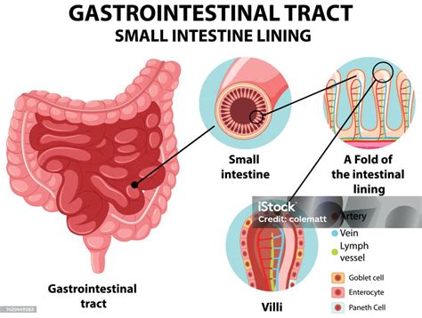Diagramma del tratto intestinale con enfasi sull'enterocolite necrotizzante