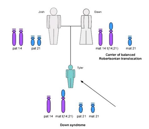 Diagramma che illustra i tre tipi di trisomia 21: trisomia libera, a mosaico e da traslocazione.