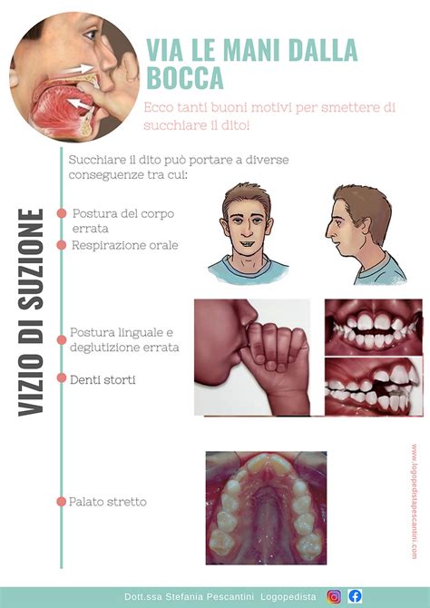Infografica comparativa: ciuccio vs. dito in bocca