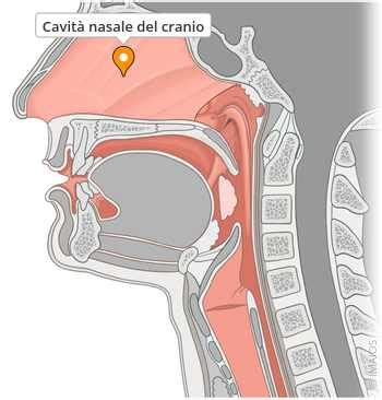 Diagramma anatomico che mostra la separazione tra cavità orale e nasale, e dove avviene la schisi