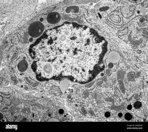 Sezione trasversale del flagello di uno spermatozoo al microscopio elettronico