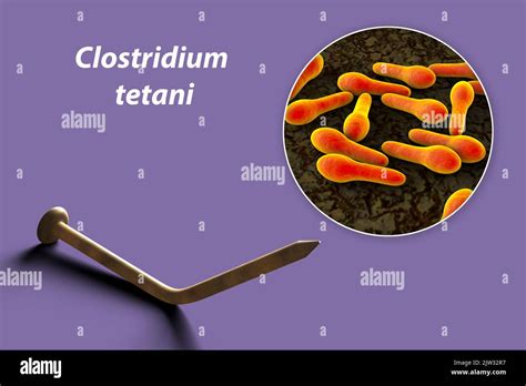 Ciclo di infezione del Clostridium tetani