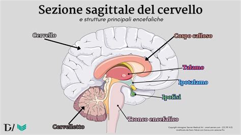Rappresentazione di un cervello con aree di attenzione e iperattività
