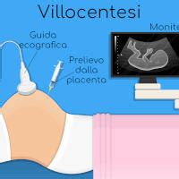 Ecografia Villocentesi