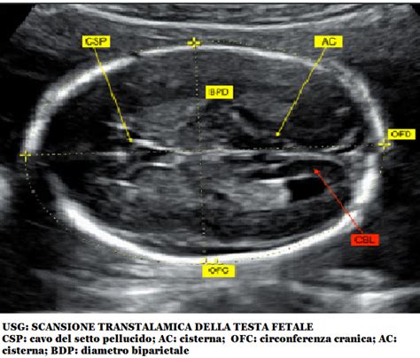 Scansione ecografica fetale dell'asse lungo del ventricolo sinistro