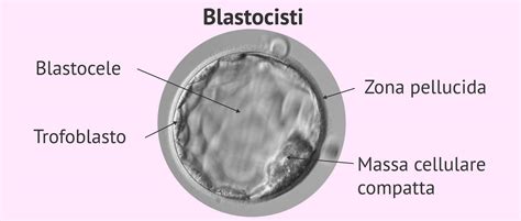 Struttura di una blastocisti umana con massa cellulare interna e trofoectoderma