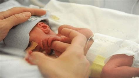 Dettaglio della lanugine su neonato prematuro