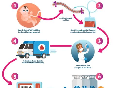 Image depicting the collection of umbilical cord blood