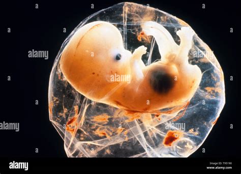 Embrione umano con i primi abbozzi di organi