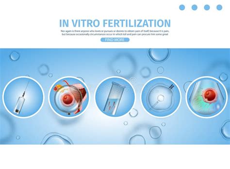 Illustrazione del processo di prelievo ovocitario