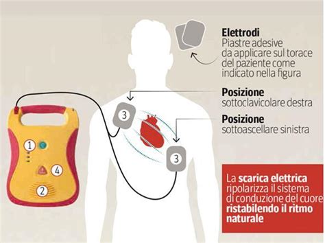 Posizionamento elettrodi defibrillatore bambino