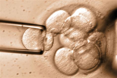 Biopsia della blastocisti per Diagnosi Genetica Preimpianto (PGT)