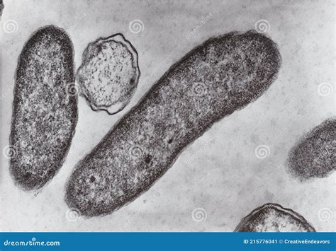 Microscopio elettronico di batteri streptococchi