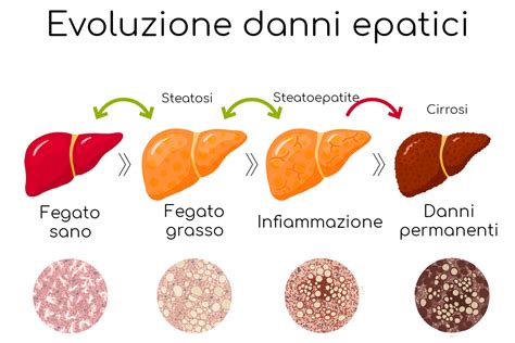 Diagramma del fegato con aree di danno da sovradosaggio