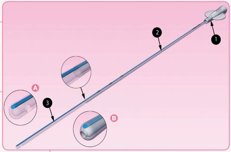 Illustrazione dettagliata di un catetere per inseminazione artificiale in ovini