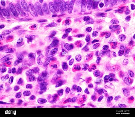 Microscopio che mostra cellule endometriali
