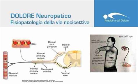 Impatto del Dolore Neuropatico