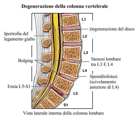 Schema anatomico colonna vertebrale e spazi epidurale spinale