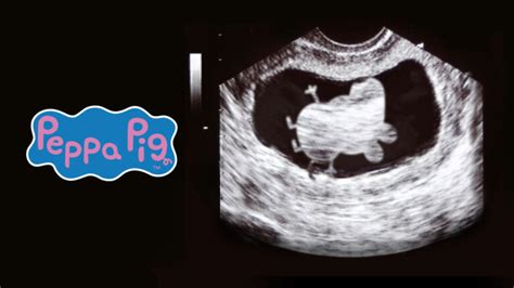 Mamma Pig ecografia
