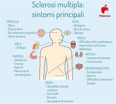 Sclerosi multipla: sintomatologia e impatto