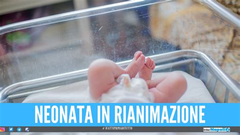 Neonata sottoposta a rianimazione