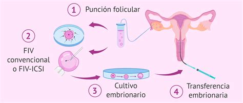 Schematizzazione del processo di FIV con IA