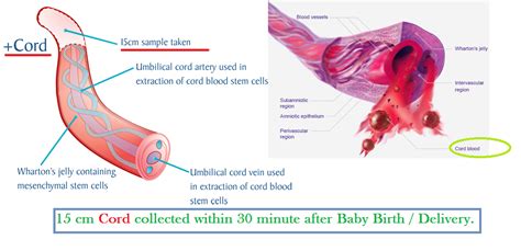 Cord blood collection procedure