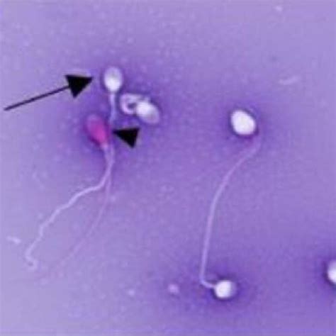 Sperm viability in different environments infographic