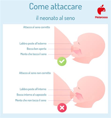 Illustrazione della trasformazione del seno durante e dopo l'allattamento