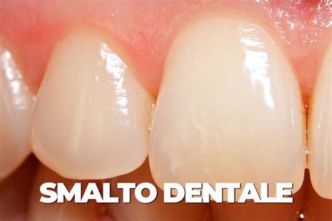 rappresentazione grafica dello smalto dentale che si remineralizza grazie al fluoro