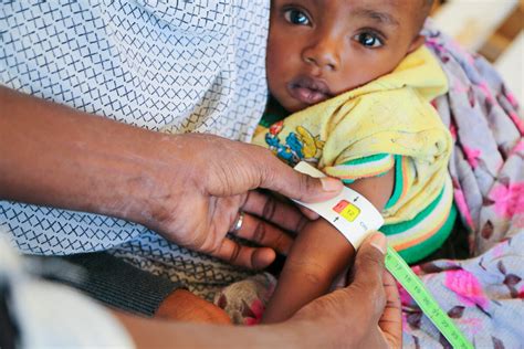 Operatori sanitari che misurano la circonferenza del braccio di un bambino