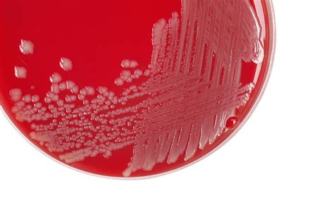 rappresentazione microscopica di colonie batteriche su una piastra di Petri