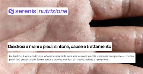 Diagramma dei fattori scatenanti della disidrosi
