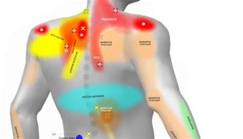 Zone del corpo tipicamente interessate dall'eczema gravidico