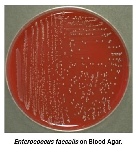 Struttura dell'Enterococcus faecalis