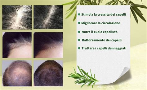 diagramma esplicativo che mostra come l'olio ammorbidisce le crosticine del cuoio capelluto