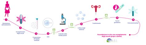 infografica sulle opzioni di preservazione della fertilità femminile