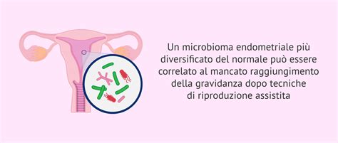 Microbiota endometriale e impianto