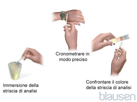 guida visiva alla corretta procedura di campionamento delle urine per test fertilità