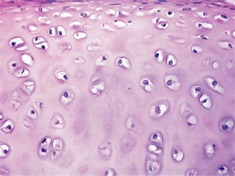 Microscopic view of hyaline cartilage