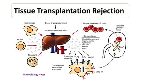 Comparison of tissue rejection mechanisms