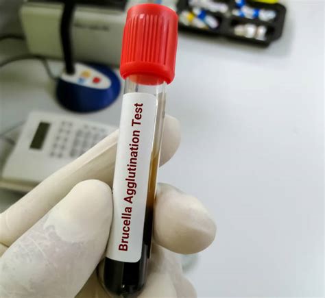 Test diagnostico per Brucellosi