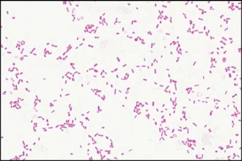 Immagine al microscopio di Klebsiella pneumoniae